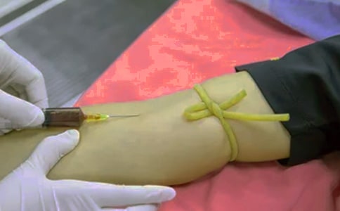卵巢癌患者能保留生育功能吗?